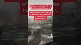 Kallmann syndrome  absent puberty with anosmia [upl. by Pius]