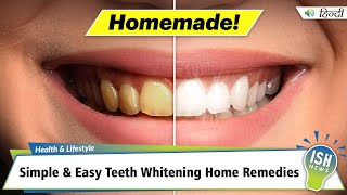 Simple amp Easy Teeth Whitening Home Remedies  ISH News [upl. by Sewellyn]