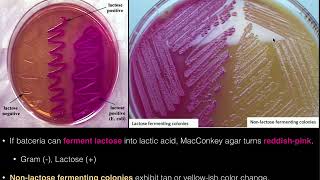 MacConkey Agar [upl. by Ailin]