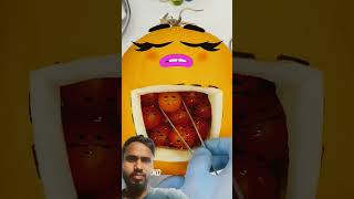 Goodland melon surgery goodlandfruitsurgetydoodlessausagecartoonfunny [upl. by Jerrilyn688]