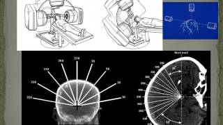 SRS Lecture 2 Stereotactic Imng w audio [upl. by Baldwin]