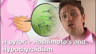 H pylori  Hashimotos and Hypothyroidism [upl. by Ludba59]