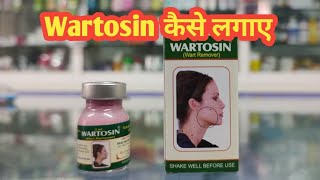 Wartosin Wart Remover l Wartosin kaise Lagaye l Price  Uses in Hindi l How to Use l [upl. by Annie]