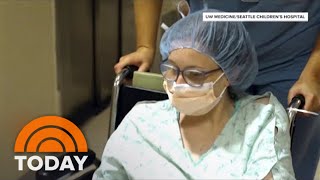 Survivor Of Conjoined Twin Surgery Gives Birth To Her Own Baby [upl. by Natalina]