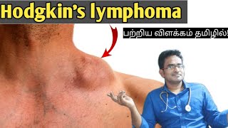 Hodgkins lymphoma medical awareness in tamil [upl. by Betti777]