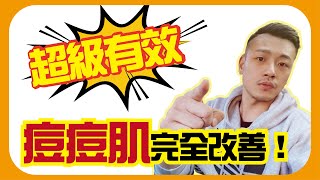 對抗青春痘大作戰 ！還我漂漂拳 ！！【77老大】 [upl. by Johnette292]