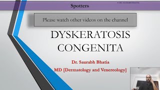 Dyskeratosis Congenita [upl. by Ayote994]