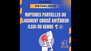 Rupture Partielle du LCA  Comprendre Diagnostiquer et Traiter LCA Kinésithérapie [upl. by Ahsinroc]