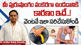 మీ అంగం ఇలా ఉందా  How to Fix Tight Frenulum  Tight Frenulum Treatment  Treatment Range Hospital [upl. by Jabin]