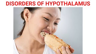 Disorders of Hypothalamus [upl. by Crowns426]