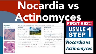 Nocardia vs Actinomyces in HindiUrdu by first aid for USMLE step 1 [upl. by Belamy473]