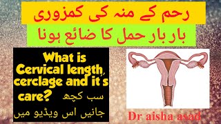 What is cervical Cerclage what is short cervix urduhindi [upl. by Kram457]