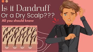 Is It Dandruff Or A Dry Scalp Heres What You Need To Know [upl. by Gen]