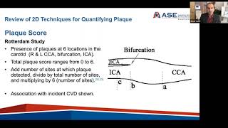 Carotid Arterial Plaque by Ultrasound  Characterization of Atherosclerosis amp Evaluation of CV Risk [upl. by Iyre]