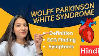 WolffParkinsonWhite WPW Syndrome in Hindi  ECG findings Diagnosis Treatment [upl. by Kyte]