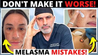 Melasma mistakes that can ruin your skin and make hyperpigmentation worse [upl. by Nevlin]