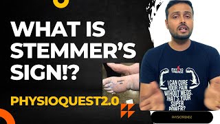 What is Stemmers sign and How to Test it  PHYSIOQUEST 20 [upl. by Jeanne]