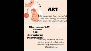 Seminar on FEMALE INFERTILITY 🤞 youtubeshorts medicalstudent female education trendingshorts [upl. by Fabria]