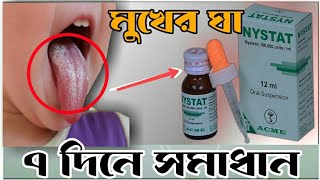 Nystat Oral Suspension।।How To Use Nystat।।মুখের ঘা দূর করার সেরা ঔষধNystst Drop [upl. by Eidson]