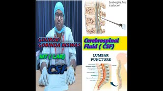 Cerebrospinal Fluid in Bangla test report Cerebrospinal fluid CSF [upl. by Ramel]