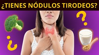 ¿TIENES NÓDULOS TIROIDEOS síntomas diagnóstico y tratamiento [upl. by Ahserkal]