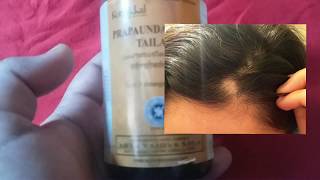 Kottakkal Hair Oil Review in Tamil Prapaundarikadi Tailm Review [upl. by Ycul]