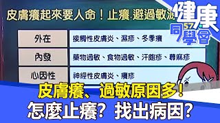 皮膚癢、過敏原因多！ 怎麼止癢？找出病因？【57健康同學會】20211128｜廖慶學 嚴立婷 [upl. by Dorie]