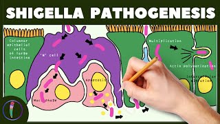 Shigella Pathogenesis Simplified [upl. by Airelav99]