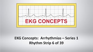 EKG Concepts Arrhythmias Course  Strip 6 of 39 [upl. by Janis731]