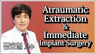 Dentalbean Atraumatic Extraction amp Immediate Implant surgery [upl. by Marchelle42]