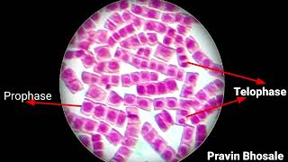 How to identify mitosis stages under microscope  Mitosis Slide  Prophase  Metaphase  Anaphase [upl. by Heim]