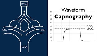 Waveform Capnography  BAVLS [upl. by Bowra]