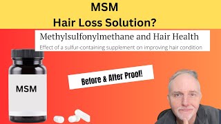 MSM for Fuller Healthier Hair Growth Latest Research [upl. by Ardrey]