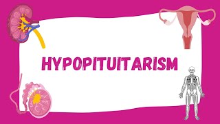 Hypopituitarism  Causes Symptoms Diagnosis Treatment  Endocrinology [upl. by Erhart]