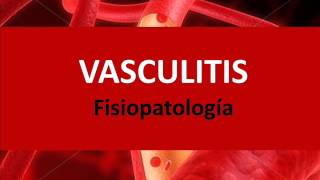 Vasculitis  Fisiopatología [upl. by Eciruam863]