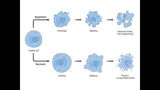 NECROSIS  CAUSES  PROCESS  PHYSIOLOGY  IN TAMIL  SARATH LECTURES [upl. by Woermer439]