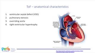 Tetralogy of Fallot [upl. by Conny]