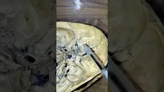 Anterior cranial fossa spotting video easy explanation [upl. by Akinohs]