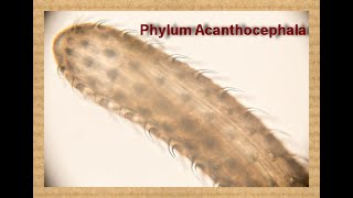 Phylum Acanthocephala quot Thornyheaded worms Dr Manar Elmehankar [upl. by Nagrom]