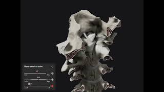 Biomechanics of the Spine App  craniocervical junction [upl. by Anawik]