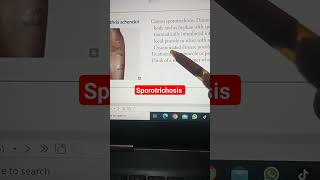 Sporotrichosis Sporothrix schenckii microbiology mycology fungus usmle [upl. by Ajax]