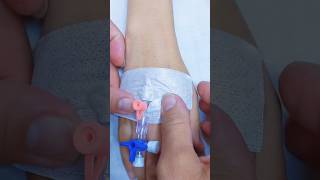 IV Cannulation subscribe health ivcannulation shortsindia [upl. by Ben]