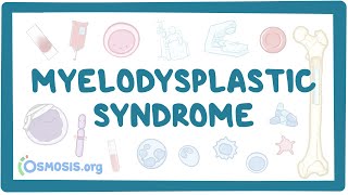 Myelodysplastic syndromes  causes symptoms diagnosis treatment pathology [upl. by Thorn]