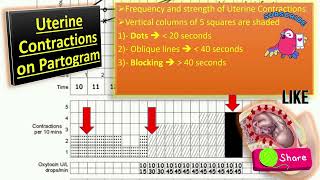 Partogram Made Easy [upl. by Nyleimaj908]