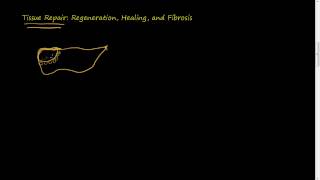 31 Tissue Repair Regeneration Healing Fibrosis [upl. by Gnol]