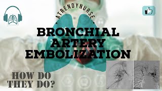 What Is Bronchial Artery Embolization  How They Are Doing It [upl. by Ned]