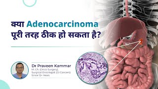 Adenocarcinoma Is a Complete Cure Possible  Cancer QampA  Dr Praveen Kammar Mumbai [upl. by Kirkwood]