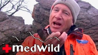 Wilderness Medicine Altitude Illness  Diamox Acetazolamide [upl. by Eriuqs424]