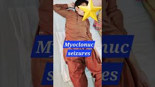 Myoclonic seizures  Myoclonus  SSPE  Epilepsy pediatrics neurology doctor [upl. by Siderf24]