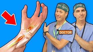 Carpal Tunnel Syndrome  Causes and Treatments [upl. by Nnanaej]